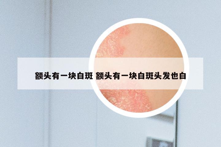 额头有一块白斑 额头有一块白斑头发也白