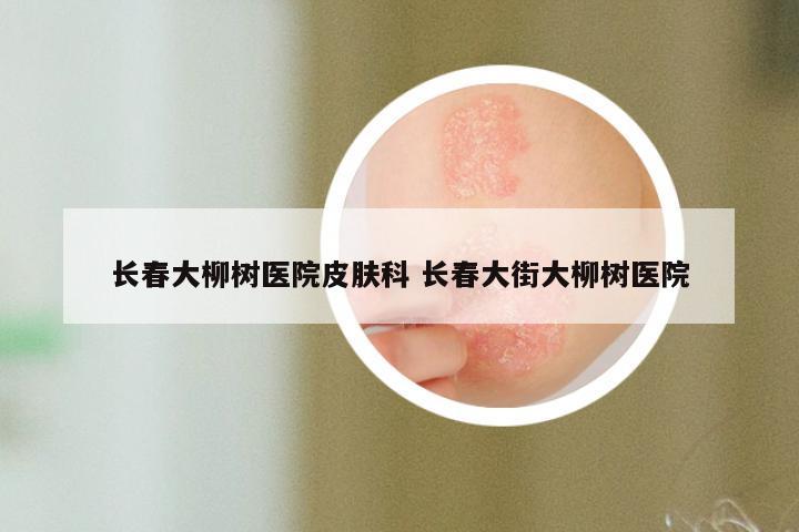 长春大柳树医院皮肤科 长春大街大柳树医院