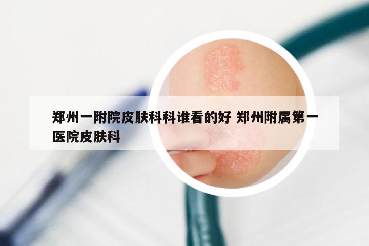 郑州一附院皮肤科科谁看的好 郑州附属第一医院皮肤科