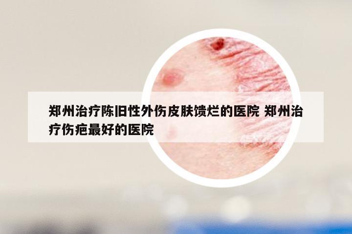 郑州治疗陈旧性外伤皮肤馈烂的医院 郑州治疗伤疤最好的医院