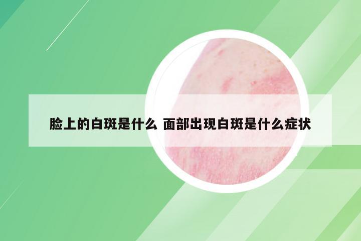 脸上的白斑是什么 面部出现白斑是什么症状