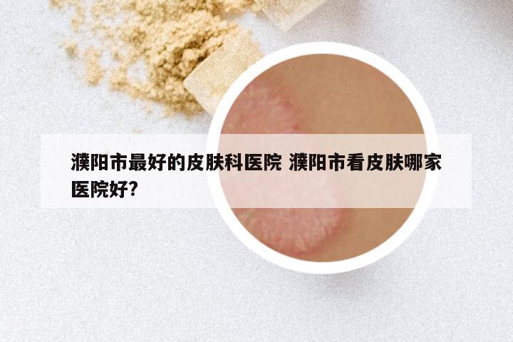 濮阳市最好的皮肤科医院 濮阳市看皮肤哪家医院好?