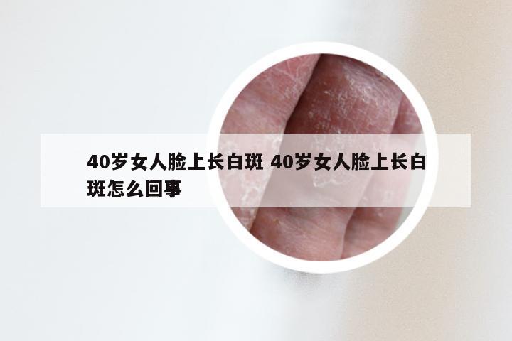 40岁女人脸上长白斑 40岁女人脸上长白斑怎么回事