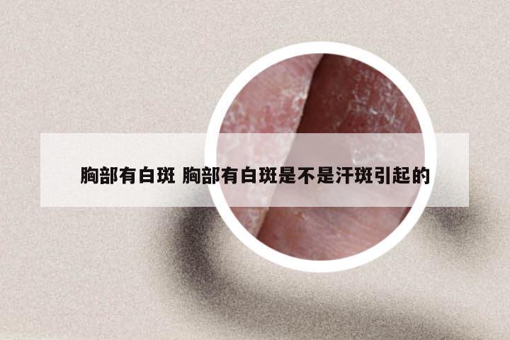 胸部有白斑 胸部有白斑是不是汗斑引起的