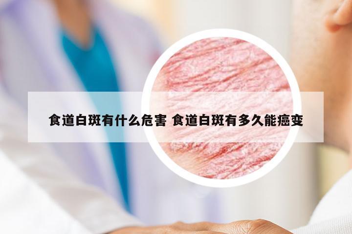 食道白斑有什么危害 食道白斑有多久能癌变