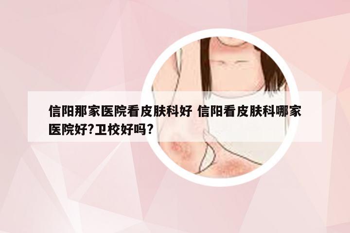 信阳那家医院看皮肤科好 信阳看皮肤科哪家医院好?卫校好吗?