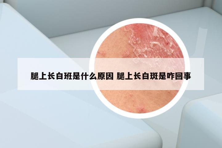 腿上长白班是什么原因 腿上长白斑是咋回事