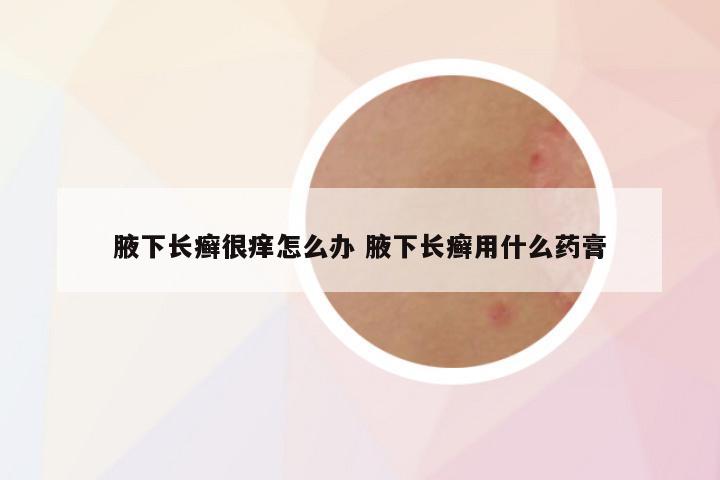 腋下长癣很痒怎么办 腋下长癣用什么药膏