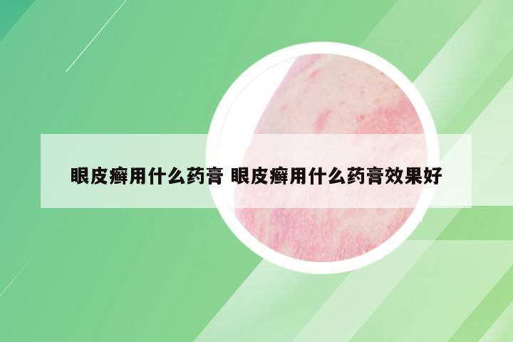 眼皮癣用什么药膏 眼皮癣用什么药膏效果好