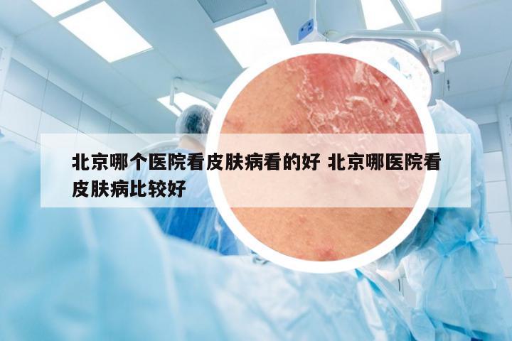 北京哪个医院看皮肤病看的好 北京哪医院看皮肤病比较好