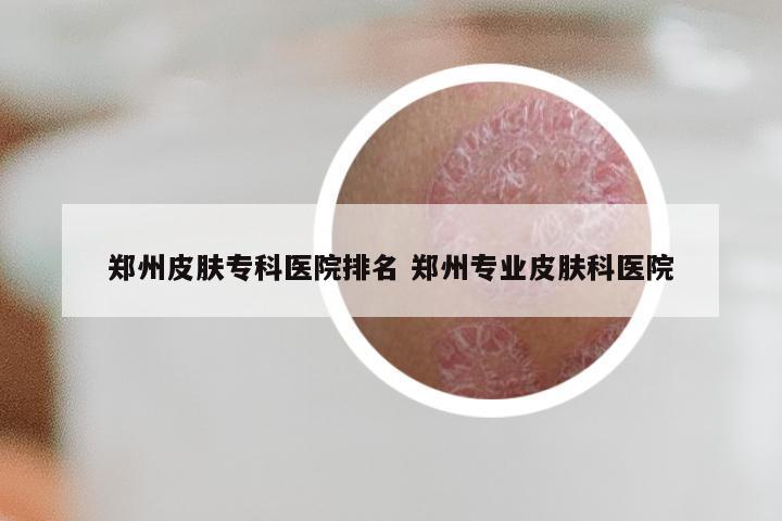 郑州皮肤专科医院排名 郑州专业皮肤科医院