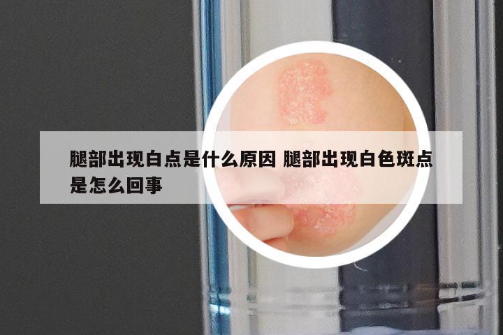 腿部出现白点是什么原因 腿部出现白色斑点是怎么回事