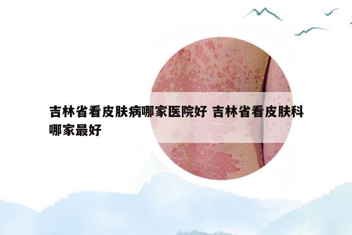 吉林省看皮肤病哪家医院好 吉林省看皮肤科哪家最好