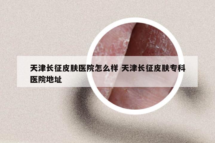 天津长征皮肤医院怎么样 天津长征皮肤专科医院地址