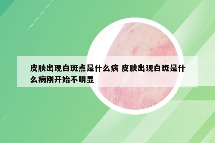 皮肤出现白斑点是什么病 皮肤出现白斑是什么病刚开始不明显