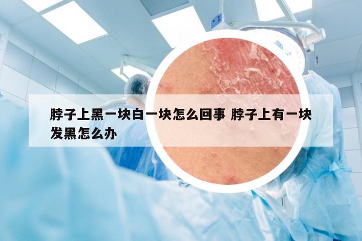 脖子上黑一块白一块怎么回事 脖子上有一块发黑怎么办