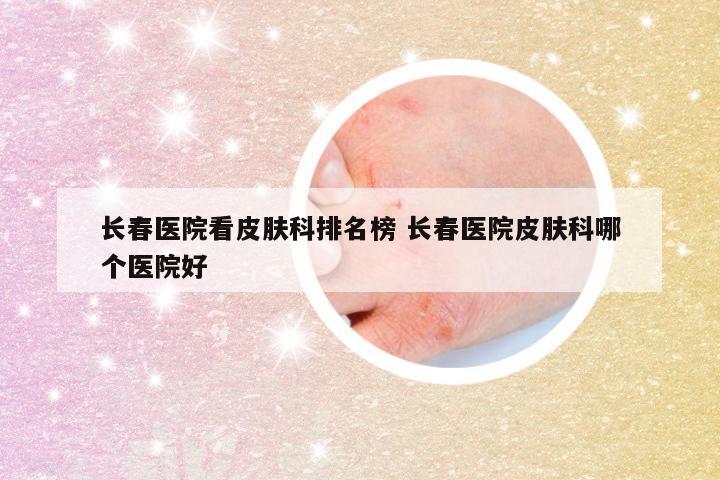 长春医院看皮肤科排名榜 长春医院皮肤科哪个医院好