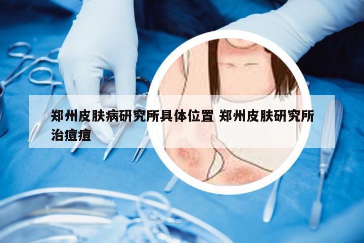 郑州皮肤病研究所具体位置 郑州皮肤研究所治痘痘