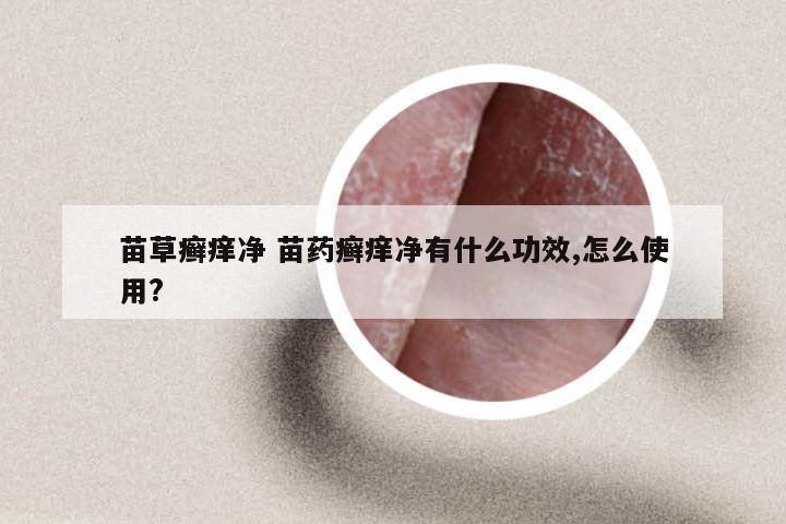 苗草癣痒净 苗药癣痒净有什么功效,怎么使用?