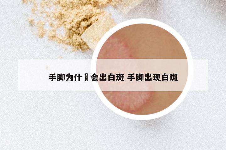 手脚为什麼会出白斑 手脚出现白斑