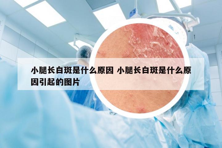 小腿长白斑是什么原因 小腿长白斑是什么原因引起的图片