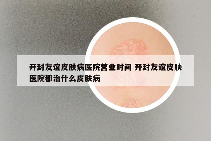 开封友谊皮肤病医院营业时间 开封友谊皮肤医院都治什么皮肤病