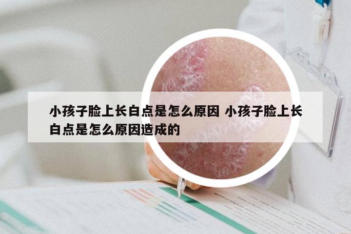 小孩子脸上长白点是怎么原因 小孩子脸上长白点是怎么原因造成的