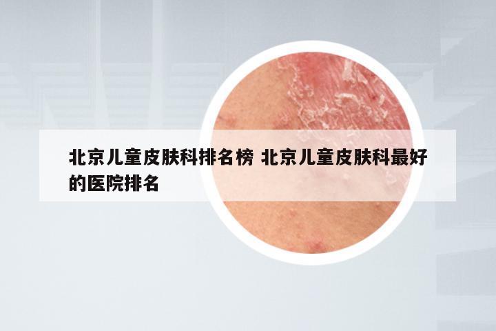 北京儿童皮肤科排名榜 北京儿童皮肤科最好的医院排名