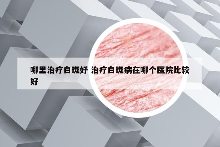 哪里治疗白斑好 治疗白斑病在哪个医院比较好