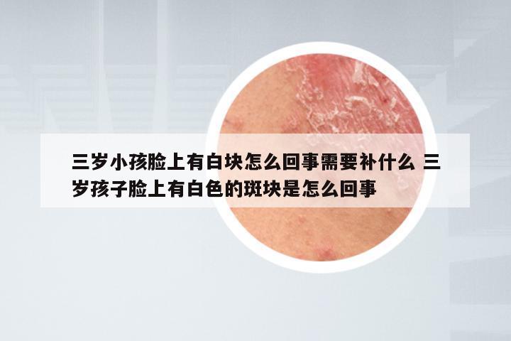 三岁小孩脸上有白块怎么回事需要补什么 三岁孩子脸上有白色的斑块是怎么回事