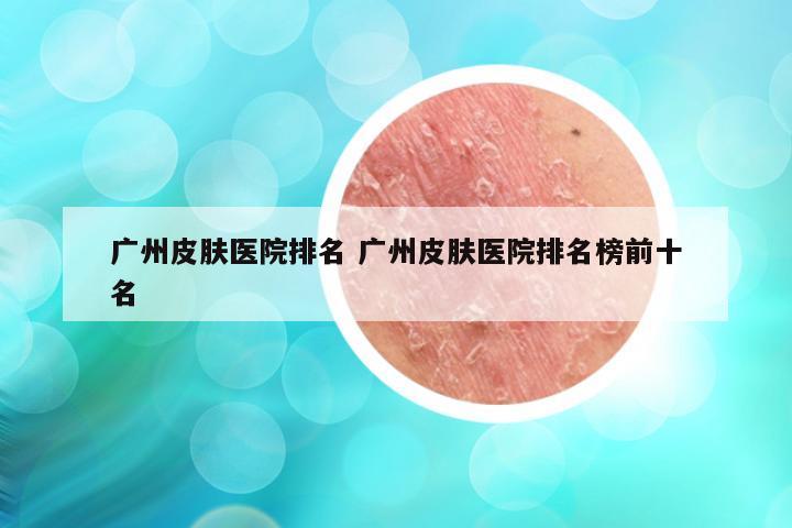 广州皮肤医院排名 广州皮肤医院排名榜前十名