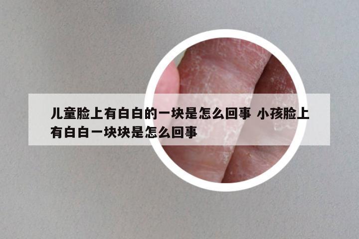 儿童脸上有白白的一块是怎么回事 小孩脸上有白白一块块是怎么回事