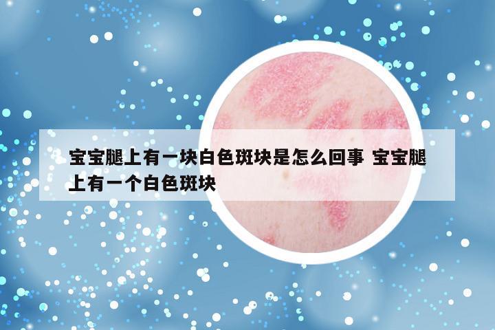 宝宝腿上有一块白色斑块是怎么回事 宝宝腿上有一个白色斑块