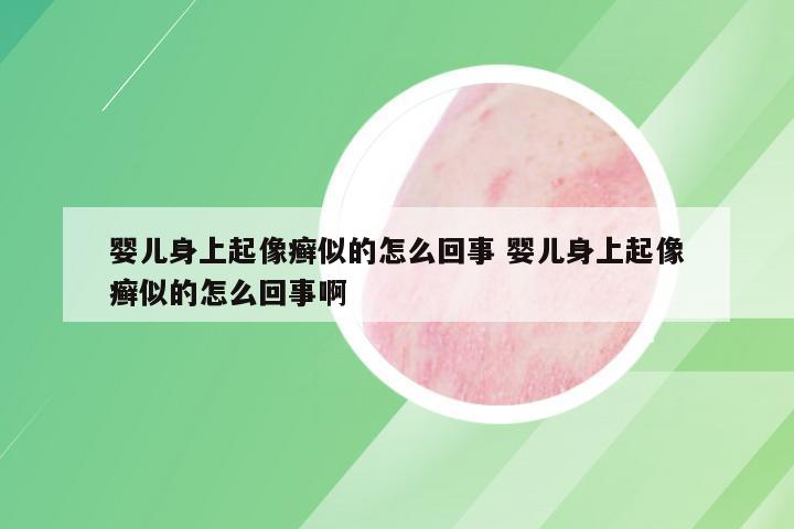 婴儿身上起像癣似的怎么回事 婴儿身上起像癣似的怎么回事啊