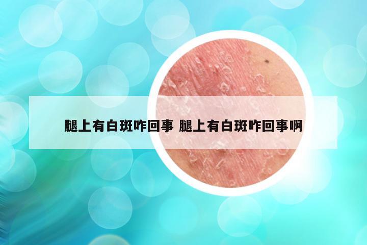 腿上有白斑咋回事 腿上有白斑咋回事啊