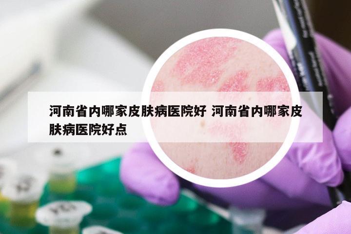 河南省内哪家皮肤病医院好 河南省内哪家皮肤病医院好点