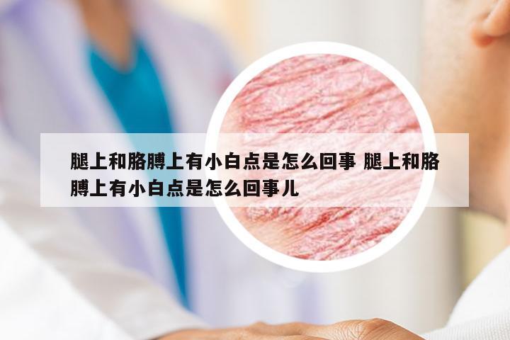 腿上和胳膊上有小白点是怎么回事 腿上和胳膊上有小白点是怎么回事儿