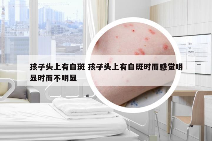 孩子头上有白斑 孩子头上有白斑时而感觉明显时而不明显