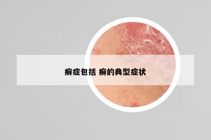 癣症包括 癣的典型症状
