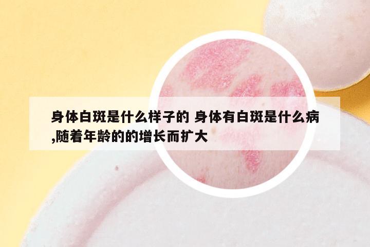 身体白斑是什么样子的 身体有白斑是什么病,随着年龄的的增长而扩大
