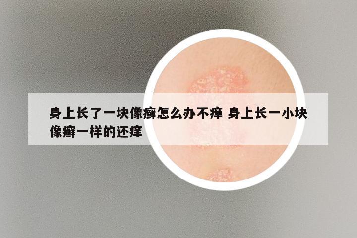 身上长了一块像癣怎么办不痒 身上长一小块像癣一样的还痒