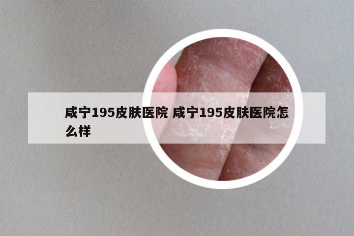 咸宁195皮肤医院 咸宁195皮肤医院怎么样