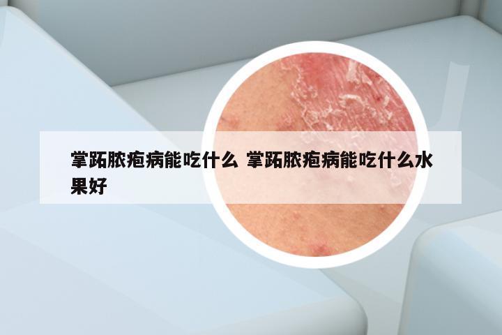 掌跖脓疱病能吃什么 掌跖脓疱病能吃什么水果好