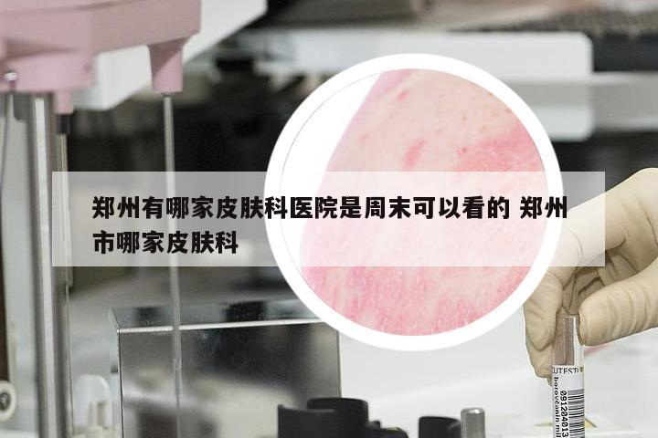 郑州有哪家皮肤科医院是周末可以看的 郑州市哪家皮肤科