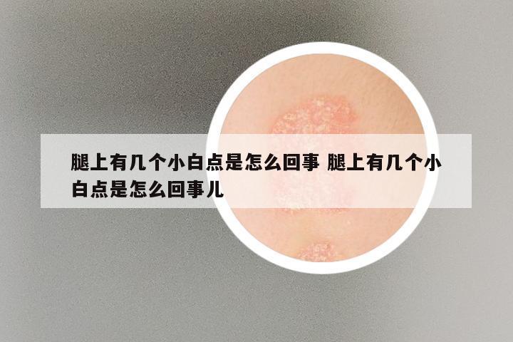 腿上有几个小白点是怎么回事 腿上有几个小白点是怎么回事儿