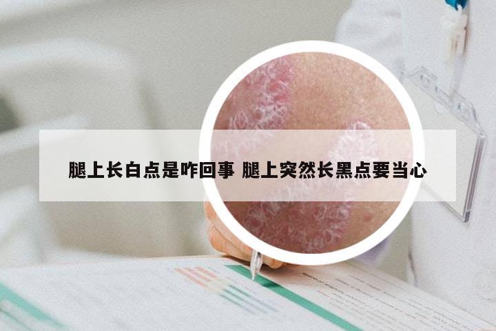 腿上长白点是咋回事 腿上突然长黑点要当心