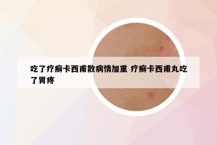 吃了疗癣卡西甫散病情加重 疗癣卡西甫丸吃了胃疼