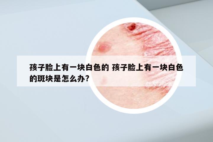 孩子脸上有一块白色的 孩子脸上有一块白色的斑块是怎么办?