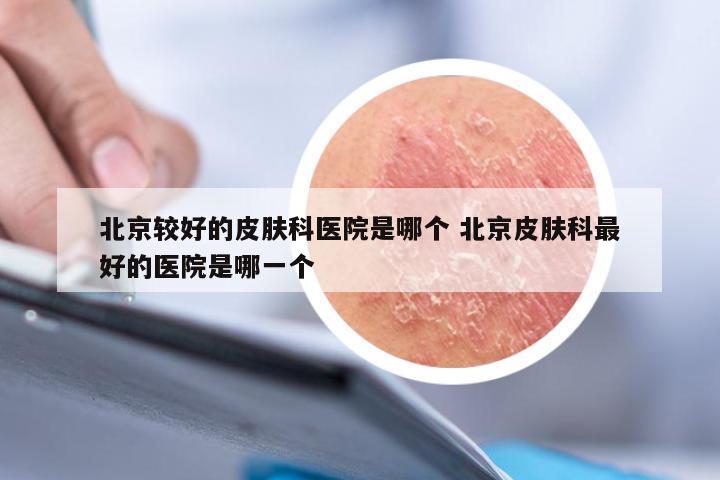 北京较好的皮肤科医院是哪个 北京皮肤科最好的医院是哪一个