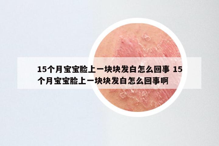 15个月宝宝脸上一块块发白怎么回事 15个月宝宝脸上一块块发白怎么回事啊